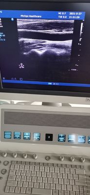 PH L12-5 Diagnóstico Médico Transdutor de sonda linear ultrasônica para PH HD9 Compatível